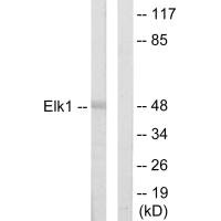 Western blot analysis of extracts from HeLa cells, using Elk1 antibody.