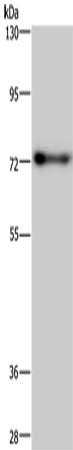 Gel: 6%SDS-PAGE, Lysate: 40 ug, Lane: Mouse brain tissue, Primary antibody: CSB-PA593186(PATZ1 Antibody) at dilution 1/250, Secondary antibody: Goat anti rabbit IgG at 1/8000 dilution, Exposure time: 40 seconds