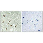 Immunohistochemistry analysis of paraffin-embedded human brain tissue using PKC θ antibody.