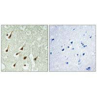 Immunohistochemistry analysis of paraffin-embedded human brain tissue using PKC θ antibody.