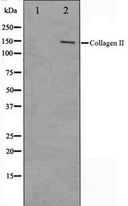 Western blot analysis on COLO205 cell lysate using Collagen II Antibody