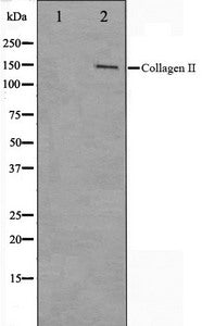 Western blot analysis on COLO205 cell lysate using Collagen II Antibody