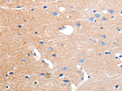 The image on the left is immunohistochemistry of paraffin-embedded Human brain tissue using CSB-PA593481(KCNH3 Antibody) at dilution 1/12, on the right is treated with synthetic peptide. (Original magnification: ×200)