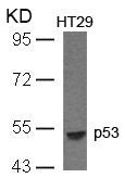 Western blot analysis of extracts from HT29 cells using p53(Ab-33) Antibody.