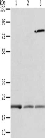 Gel: 12+15%SDS-PAGE, Lysate: 40 ug, Lane 1-3: Human fetal liver tissue, Human liver cancer tissue, human placenta tissue, Primary antibody: CSB-PA593648(APOM Antibody) at dilution 1/300, Secondary antibody: Goat anti rabbit IgG at 1/8000 dilution,...