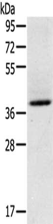 Gel: 8%SDS-PAGE, Lysate: 40 ug, Lane: Mouse brain tissue, Primary antibody: CSB-PA593710(GAS1 Antibody) at dilution 1/200 dilution, Secondary antibody: Goat anti rabbit IgG at 1/8000 dilution, Exposure time: 40 seconds