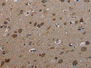 The image on the left is immunohistochemistry of paraffin-embedded Human brain tissue using CSB-PA593946(GSTA3 Antibody) at dilution 1/30, on the right is treated with fusion protein. (Original magnification: ×200)