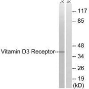 Western blot analysis of extracts from Jurkat cells, using Vitamin D3 Receptor (Ab-51) antibody.