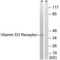 Western blot analysis of extracts from Jurkat cells, using Vitamin D3 Receptor (Ab-51) antibody.