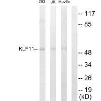 Western blot analysis of extracts from 293 cells, Jurkat cells and HuvEc cells, using KLF11 antibody.