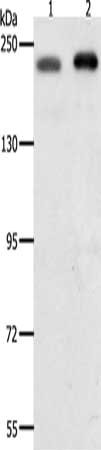 Gel: 8%SDS-PAGE, Lysate: 50 ug, Lane 1-2: Hela cells, Jurkat cells, Primary antibody: CSB-PA595142(SMARCA4 Antibody) at dilution 1/700, Secondary antibody: Goat anti rabbit IgG at 1/8000 dilution, Exposure time: 30 seconds