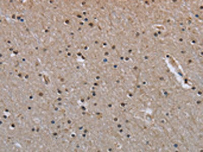 The image on the left is immunohistochemistry of paraffin-embedded Human brain tissue using CSB-PA595344(MVD Antibody) at dilution 1/40, on the right is treated with synthetic peptide. (Original magnification: ×200)