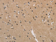 The image is immunohistochemistry of paraffin-embedded Human brain tissue using CSB-PA595538(CENPN Antibody) at dilution 1/70. (Original magnification: ×200)