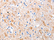 The image on the left is immunohistochemistry of paraffin-embedded Human brain tissue using CSB-PA595662(KISS1 Antibody) at dilution 1/5, on the right is treated with synthetic peptide. (Original magnification: x200)