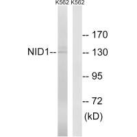 Western blot analysis of extracts from K562 cells, using NID1 antibody.