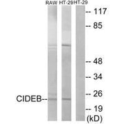 Western blot analysis of extracts from RAW264.7 cells and HT-29 cells, using CIDEB antibody.