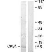 Western blot analysis of extracts from Jurkat cells, treated with serum (20%, 15mins), using CKS1 antibody.