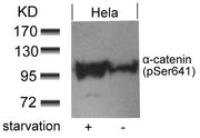 Western blot analysis of extracts from Hela cells untreated or treated with starvation using a-catenin(Phospho-Ser641) antibody.