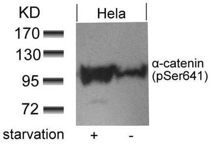 Western blot analysis of extracts from Hela cells untreated or treated with starvation using a-catenin(Phospho-Ser641) antibody.