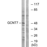 Western blot analysis of extracts from K562 cells, using GCNT7 antibody.