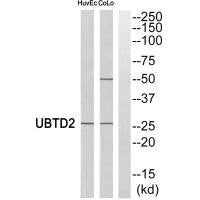 Western blot analysis of extracts from HuvEc cells and COLO cells, using UBTD2 antibody.