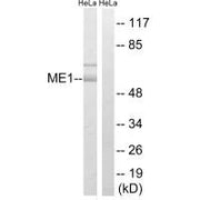 Western blot analysis of extracts from HeLa cells, using ME1 antibody.