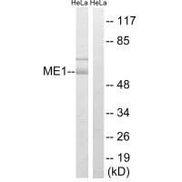 Western blot analysis of extracts from HeLa cells, using ME1 antibody.