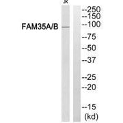 Western blot analysis of extracts from Jurkat cells, using FAM35A/B antibody.