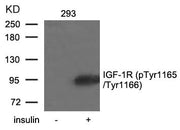 Western blot analysis of extracts from 293 cells untreated or treated with insulin using IGF-1R(Phospho-Tyr1165/Tyr1166) Antibody.