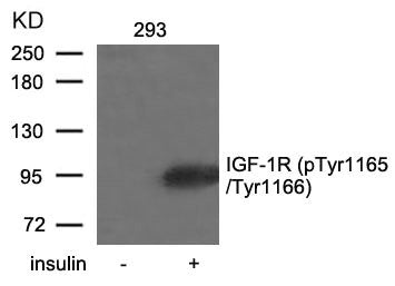 Western blot analysis of extracts from 293 cells untreated or treated with insulin using IGF-1R(Phospho-Tyr1165/Tyr1166) Antibody.