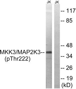 Western blot analysis of extracts from Jurkat cells treated with serum using MAP2K3 (Phospho-Thr222) Antibody.The lane on the right is treated with the antigen-specific peptide.