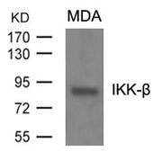 Western blot analysis of extracts from MDA cells using IKK-b(Ab-199) Antibody.