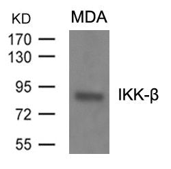 Western blot analysis of extracts from MDA cells using IKK-b(Ab-199) Antibody.