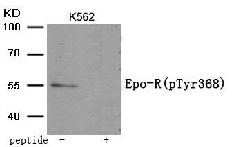 Western blot analysis of extracts from K562 tissue using Epo-R (Phospho-Tyr368) antibody.The lane on the right is treated with the antigen-specific peptide.