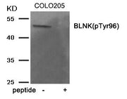 Western blot analysis of extracts from COLO205 tissue using BLNK (Phospho-Tyr96) antibody.The lane on the right is treated with the antigen-specific peptide.