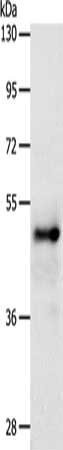 Gel: 10%SDS-PAGE, Lysate: 40 ug, Lane: Human fetal brain tissue, Primary antibody: CSB-PA599152(SOX8 Antibody) at dilution 1/500, Secondary antibody: Goat anti rabbit IgG at 1/8000 dilution, Exposure time: 2 minutes