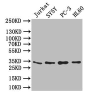 Western Blot Positive WB detected in: JK whole cell lysate,SY5Y whole cell lysate,PC-3 whole cell lysate,,HL60 whole cell lysate All lanes: UCP1 antibody at 1:1000 Secondary Goat polyclonal to rabbit IgG at 1/50000 dilution Predicted band size: 33...