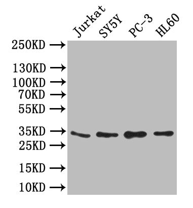 Western Blot Positive WB detected in: JK whole cell lysate,SY5Y whole cell lysate,PC-3 whole cell lysate,,HL60 whole cell lysate All lanes: UCP1 antibody at 1:1000 Secondary Goat polyclonal to rabbit IgG at 1/50000 dilution Predicted band size: 33...