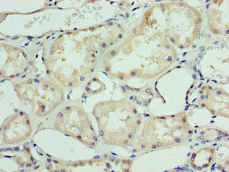 Immunohistochemistry of paraffin-embedded human kidney tissue using CSB-PA600078LA01HU at dilution of 1:100