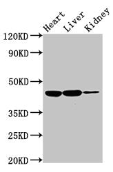 Western Blot Positive WB detected in: Rat heart tissue, Rat liver tissue, Rat kidney tissue All lanes: IL10RB antibody at 2ug/ml Secondary Goat polyclonal to rabbit IgG at 1/50000 dilution Predicted band size: 37 kDa Observed band size: 45 kDa