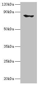 Western blot All lanes: EHHADH antibody at 2µg/ml + Mouse kidney tissue Secondary Goat polyclonal to rabbit IgG at 1/10000 dilution Predicted band size: 80, 70 kDa Observed band size: 80 kDa