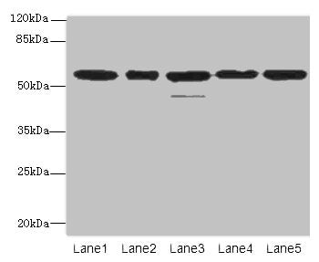 Western blot All lanes: RBBP4 antibody at 1µg/ml Lane 1: Hela whole cell lysate Lane 2: LO2 whole cell lysate Lane 3: K562 whole cell lysate Lane 4: NIH/3T3 whole cell lysate Lane 5: Raji whole cell lysate Secondary Goat polyclonal to rabbit IgG a...