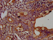 IHC image of CSB-PA600257LA01HU diluted at 1:500 and staining in paraffin-embedded human small intestine tissue performed on a Leica BondTM system. After dewaxing and hydration, antigen retrieval was mediated by high pressure in a citrate buffer (...