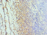 Immunohistochemistry of paraffin-embedded human tonsil tissue using CSB-PA600856ESR1HU at dilution of 1:100