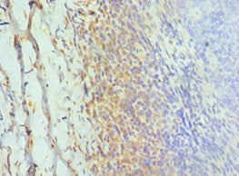 Immunohistochemistry of paraffin-embedded human tonsil tissue using CSB-PA600856ESR1HU at dilution of 1:100