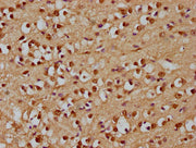 IHC image of CSB-PA600921LA01HU diluted at 1:300 and staining in paraffin-embedded human brain tissue performed on a Leica BondTM system. After dewaxing and hydration, antigen retrieval was mediated by high pressure in a citrate buffer (pH 6.0). S...
