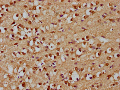IHC image of CSB-PA600921LA01HU diluted at 1:300 and staining in paraffin-embedded human brain tissue performed on a Leica BondTM system. After dewaxing and hydration, antigen retrieval was mediated by high pressure in a citrate buffer (pH 6.0). S...