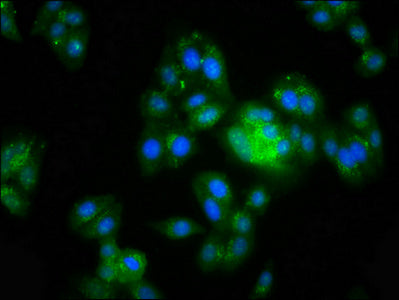 Immunofluorescence staining of HepG2 cells with CSB-PA600992LA01HU at 1:200, counter-stained with DAPI. The cells were fixed in 4% formaldehyde, permeabilized using 0.2% Triton X-100 and blocked in 10% normal Goat Serum. The cells were then incuba...