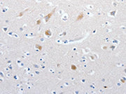 The image on the left is immunohistochemistry of paraffin-embedded Human brain tissue using CSB-PA602770(MATN1 Antibody) at dilution 1/60, on the right is treated with synthetic peptide. (Original magnification: ×200)