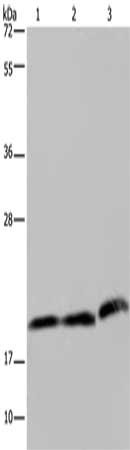 Gel: 8%SDS-PAGE, Lysate: 40 ug, Lane 1-3: Hela cells, K562 cells, human fetal liver tissue, Primary antibody: CSB-PA603901(PGLYRP1 Antibody) at dilution 1/200, Secondary antibody: Goat anti rabbit IgG at 1/8000 dilution, Exposure time: 2 minutes